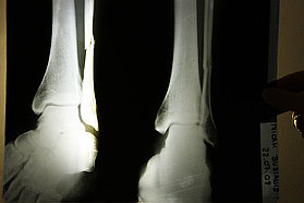 F08 ls Micah's X-ray Micah's X-ray