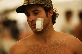 Cedric Bordes battle scars